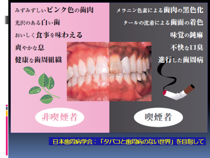 喫煙者、非喫煙者の歯肉