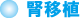 腎移植 腎移植