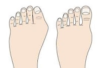 足から健康を考える 足から健康を考える